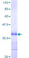 ZNF136 Protein - 12.5% SDS-PAGE Stained with Coomassie Blue.