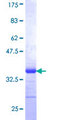 ZNF155 Protein - 12.5% SDS-PAGE Stained with Coomassie Blue.