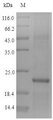 ZNF160 Protein - (Tris-Glycine gel) Discontinuous SDS-PAGE (reduced) with 5% enrichment gel and 15% separation gel.