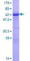 ZNF167 Protein - 12.5% SDS-PAGE of human ZNF167 stained with Coomassie Blue