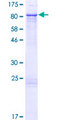 ZNF169 Protein - 12.5% SDS-PAGE of human ZNF169 stained with Coomassie Blue