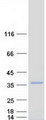 ZNF174 Protein - Purified recombinant protein ZNF174 was analyzed by SDS-PAGE gel and Coomassie Blue Staining