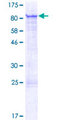 ZNF18 Protein - 12.5% SDS-PAGE of human ZNF18 stained with Coomassie Blue