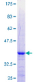 ZNF180 Protein - 12.5% SDS-PAGE Stained with Coomassie Blue.