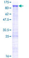 ZNF182 / ZNF21 Protein - 12.5% SDS-PAGE of human ZNF182 stained with Coomassie Blue