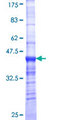 ZNF182 / ZNF21 Protein - 12.5% SDS-PAGE Stained with Coomassie Blue.