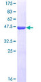 ZNF184 Protein - 12.5% SDS-PAGE Stained with Coomassie Blue.