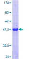 ZNF192 Protein - 12.5% SDS-PAGE Stained with Coomassie Blue.