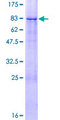 ZNF20 Protein - 12.5% SDS-PAGE of human ZNF20 stained with Coomassie Blue