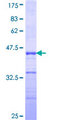 ZNF213 Protein - 12.5% SDS-PAGE Stained with Coomassie Blue.