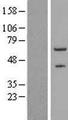 ZNF232 Protein - Western validation with an anti-DDK antibody * L: Control HEK293 lysate R: Over-expression lysate