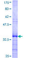 ZNF26 Protein - 12.5% SDS-PAGE Stained with Coomassie Blue