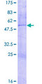 ZNF266 Protein - 12.5% SDS-PAGE of human ZNF266 stained with Coomassie Blue