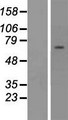 ZNF285 / ZNF285A Protein - Western validation with an anti-DDK antibody * L: Control HEK293 lysate R: Over-expression lysate