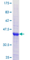 ZNF287 Protein - 12.5% SDS-PAGE Stained with Coomassie Blue.