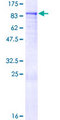 ZNF317 Protein - 12.5% SDS-PAGE of human ZNF317 stained with Coomassie Blue