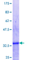 ZNF32 Protein - 12.5% SDS-PAGE Stained with Coomassie Blue