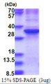 ZNF32 Protein