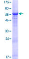 ZNF333 Protein - 12.5% SDS-PAGE of human ZNF333 stained with Coomassie Blue