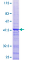 ZNF385C Protein