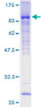 ZNF394 Protein - 12.5% SDS-PAGE of human ZNF394 stained with Coomassie Blue