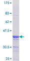 ZNF396 Protein - 12.5% SDS-PAGE Stained with Coomassie Blue.