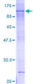 ZNF398 Protein - 12.5% SDS-PAGE of human ZNF398 stained with Coomassie Blue