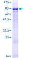 ZNF426 Protein - 12.5% SDS-PAGE of human ZNF426 stained with Coomassie Blue