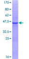 ZNF44 / GIOT-2 Protein - 12.5% SDS-PAGE of human ZNF44 stained with Coomassie Blue