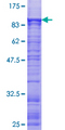 ZNF449 Protein - 12.5% SDS-PAGE of human ZNF449 stained with Coomassie Blue