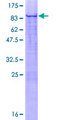 ZNF449 Protein - 12.5% SDS-PAGE of human ZNF449 stained with Coomassie Blue