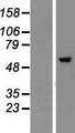 ZNF454 Protein - Western validation with an anti-DDK antibody * L: Control HEK293 lysate R: Over-expression lysate