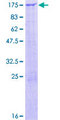 ZNF462 Protein - 12.5% SDS-PAGE of human ZNF462 stained with Coomassie Blue
