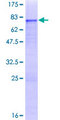 ZNF468 Protein - 12.5% SDS-PAGE of human ZNF468 stained with Coomassie Blue