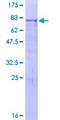 ZNF480 Protein - 12.5% SDS-PAGE of human ZNF480 stained with Coomassie Blue
