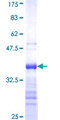 ZNF500 Protein - 12.5% SDS-PAGE Stained with Coomassie Blue.