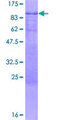 ZNF513 Protein - 12.5% SDS-PAGE of human ZNF513 stained with Coomassie Blue