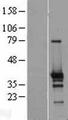 ZNF524 Protein - Western validation with an anti-DDK antibody * L: Control HEK293 lysate R: Over-expression lysate