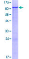 ZNF543 Protein - 12.5% SDS-PAGE of human ZNF543 stained with Coomassie Blue