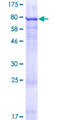 ZNF548 Protein - 12.5% SDS-PAGE of human ZNF548 stained with Coomassie Blue
