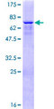 ZNF550 Protein - 12.5% SDS-PAGE of human ZNF550 stained with Coomassie Blue