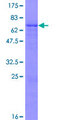 ZNF558 Protein - 12.5% SDS-PAGE of human ZNF558 stained with Coomassie Blue