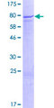 ZNF582 Protein - 12.5% SDS-PAGE of human ZNF582 stained with Coomassie Blue