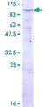 ZNF585B Protein - 12.5% SDS-PAGE of human ZNF585B stained with Coomassie Blue