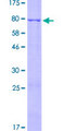 ZNF596 Protein - 12.5% SDS-PAGE of human ZNF596 stained with Coomassie Blue