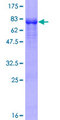 ZNF597 Protein - 12.5% SDS-PAGE of human ZNF597 stained with Coomassie Blue
