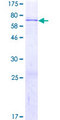 ZNF610 Protein - 12.5% SDS-PAGE of human ZNF610 stained with Coomassie Blue