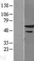 ZNF622 Protein - Western validation with an anti-DDK antibody * L: Control HEK293 lysate R: Over-expression lysate