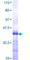 ZNF622 Protein - 12.5% SDS-PAGE Stained with Coomassie Blue.