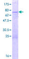 ZNF659 / ZNF385D Protein - 12.5% SDS-PAGE of human ZNF385D stained with Coomassie Blue
